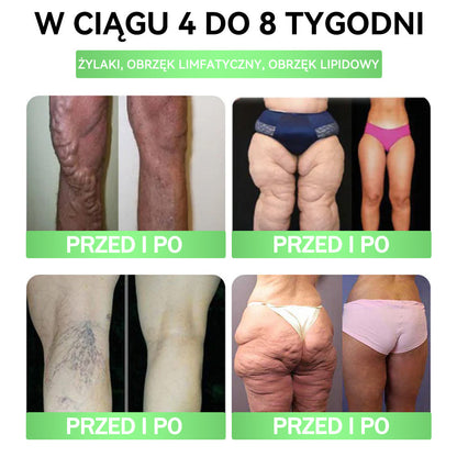 ANGELTRAP® 🎁 MEGA PROMOCJA! ✨ Zdobądź go PRAWIE ZA DARMO – dodatkowe -50% rabatu! ⏳🔥